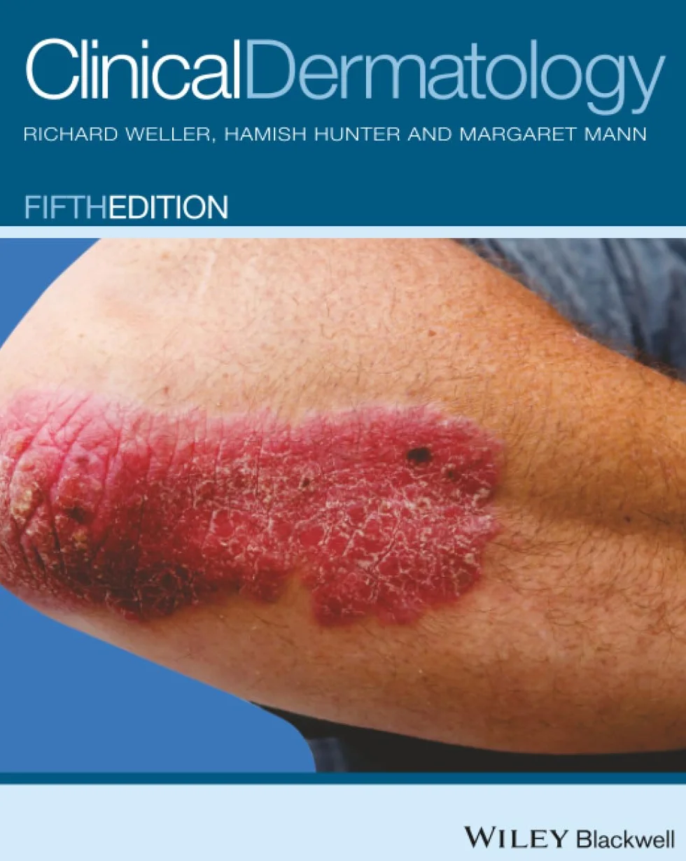Clinical Dermatology