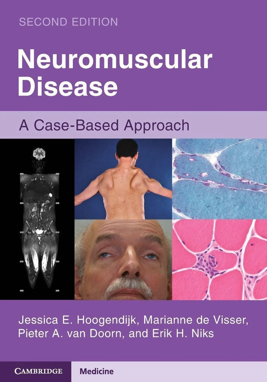 Neuromuscular Disease: A Case-Based Approach