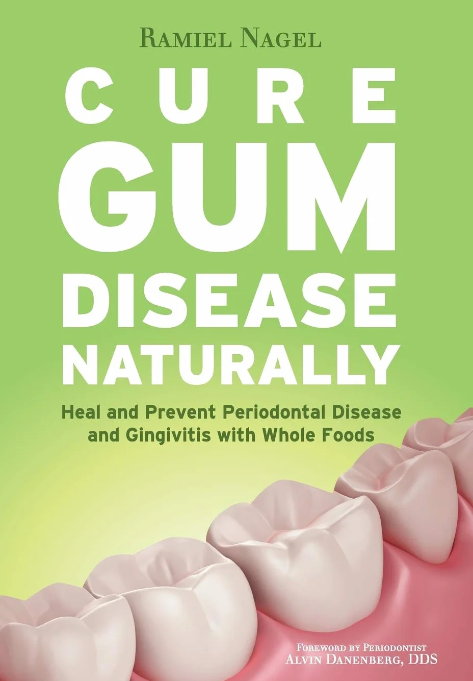 Cure Gum Disease Naturally: Heal Gingivitis and Periodontal Disease with Whole Foods