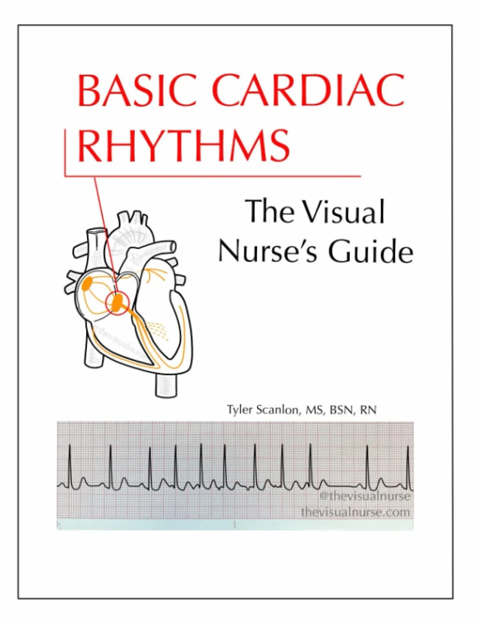 Basic Cardiac Rhythms: The Visual Nurse's Guide