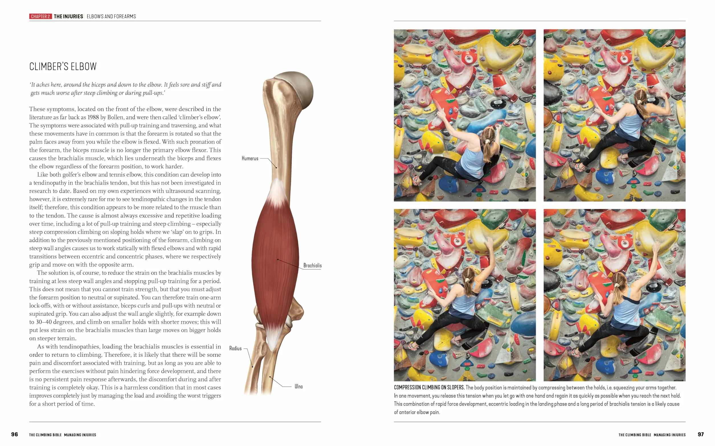 The Climbing Bible: Managing Injuries: Injury Prevention and Rehabilitation for Climbing and Bouldering: 3
