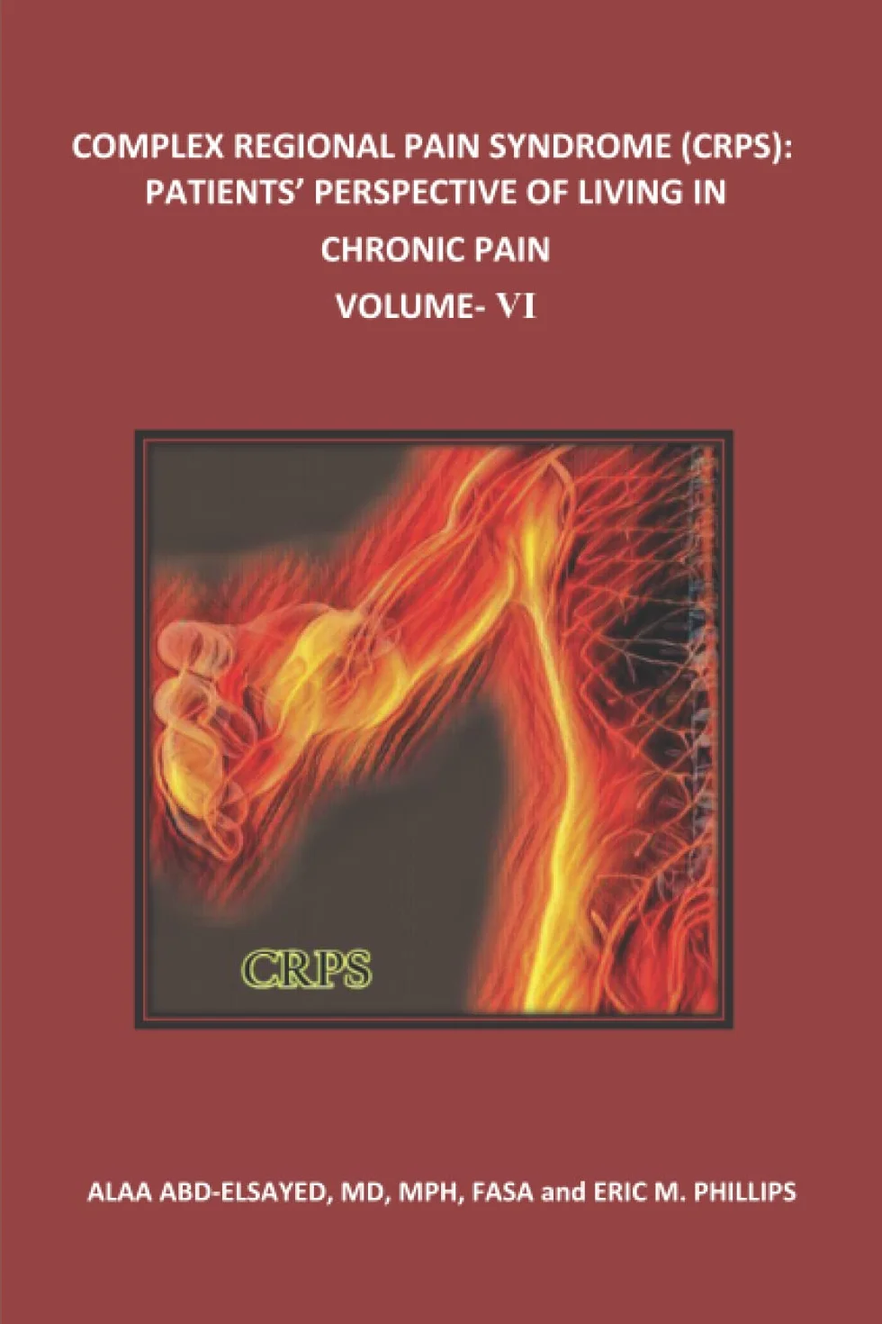 COMPLEX REGIONAL PAIN SYNDROME (CRPS): PATIENTS’ PERSPECTIVE OF LIVING IN CHRONIC PAIN Volume VI