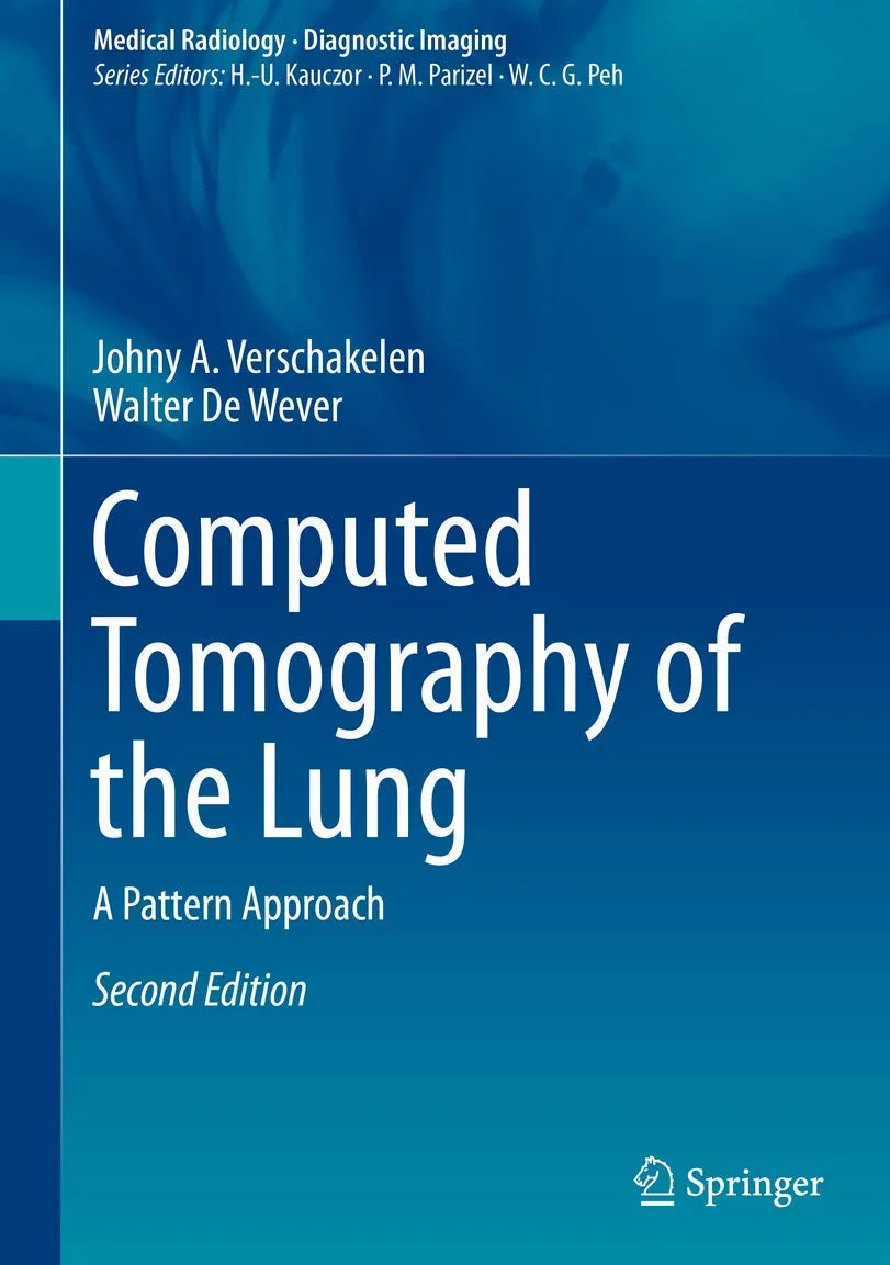 Computed Tomography of the Lung: A Pattern Approach