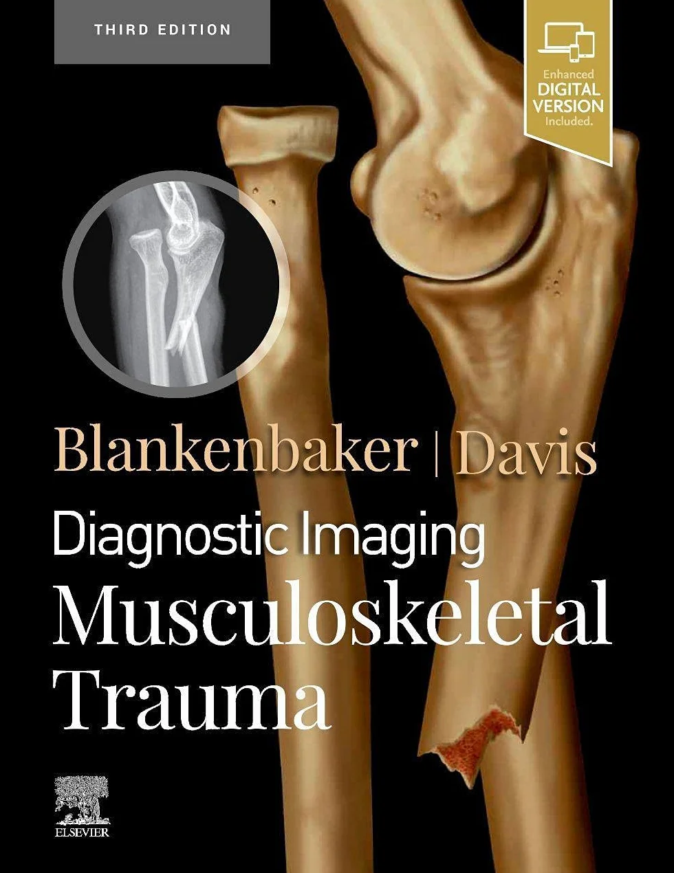 Diagnostic Imaging: Musculoskeletal Trauma