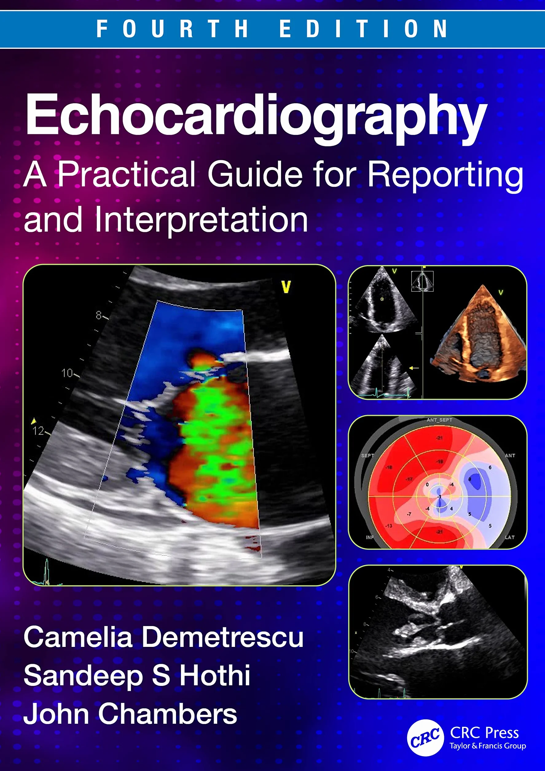 Echocardiography: A Practical Guide for Reporting and Interpretation